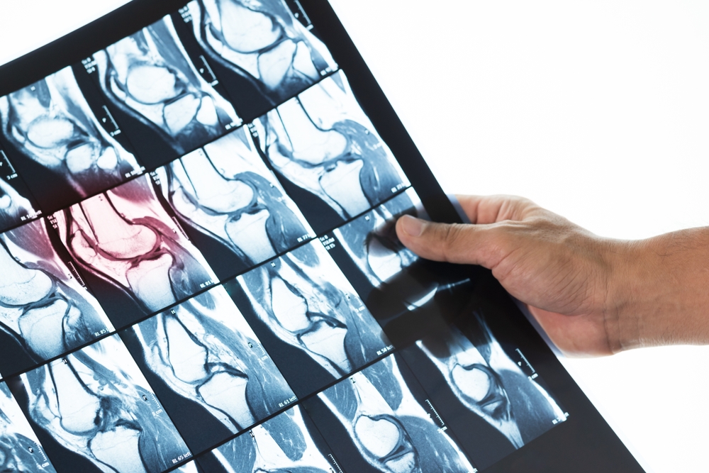 doctor showing knee scan