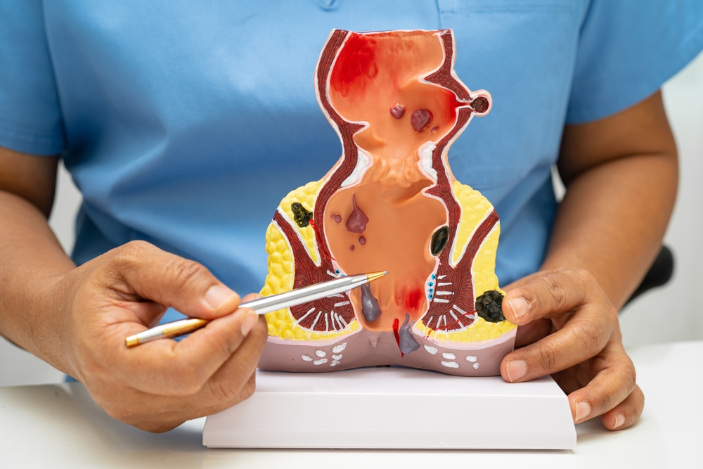 doctor showing anatomical model