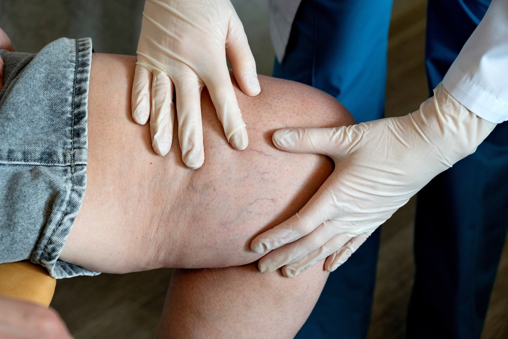 Doctor checking patient legs