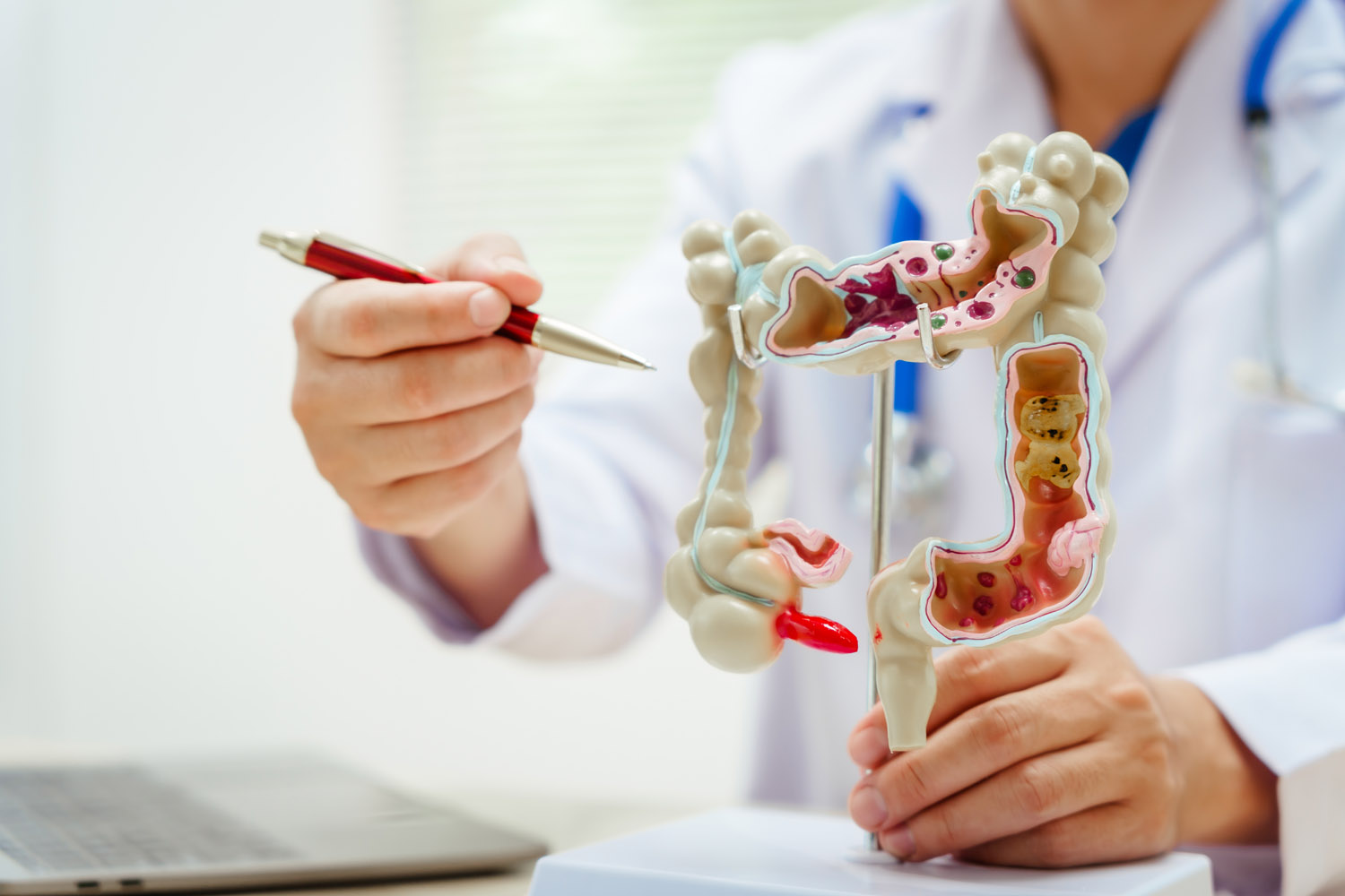 doctor showing gastrointestinal model