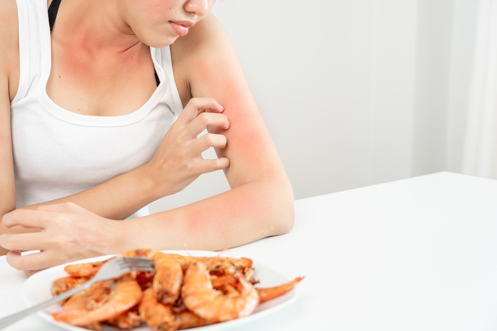Woman with an allergic reaction to shrimp at Townsen Physician Group in Houston