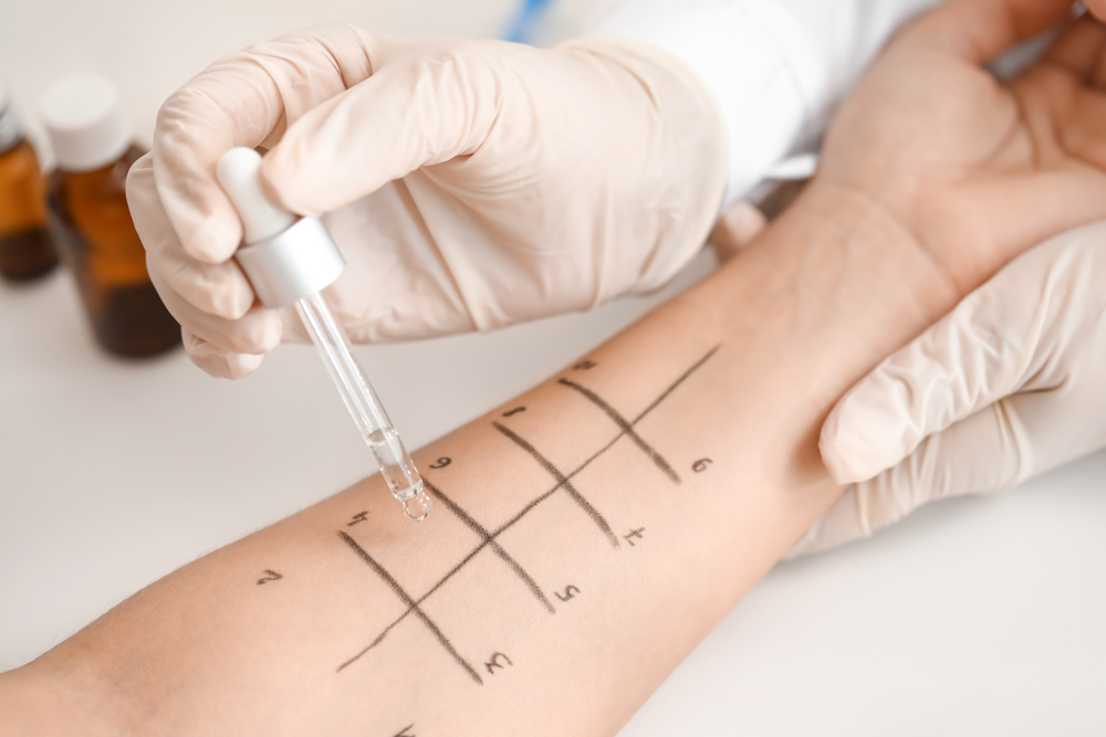 Patient getting allergy testing at Townsen Physician Group in Houston