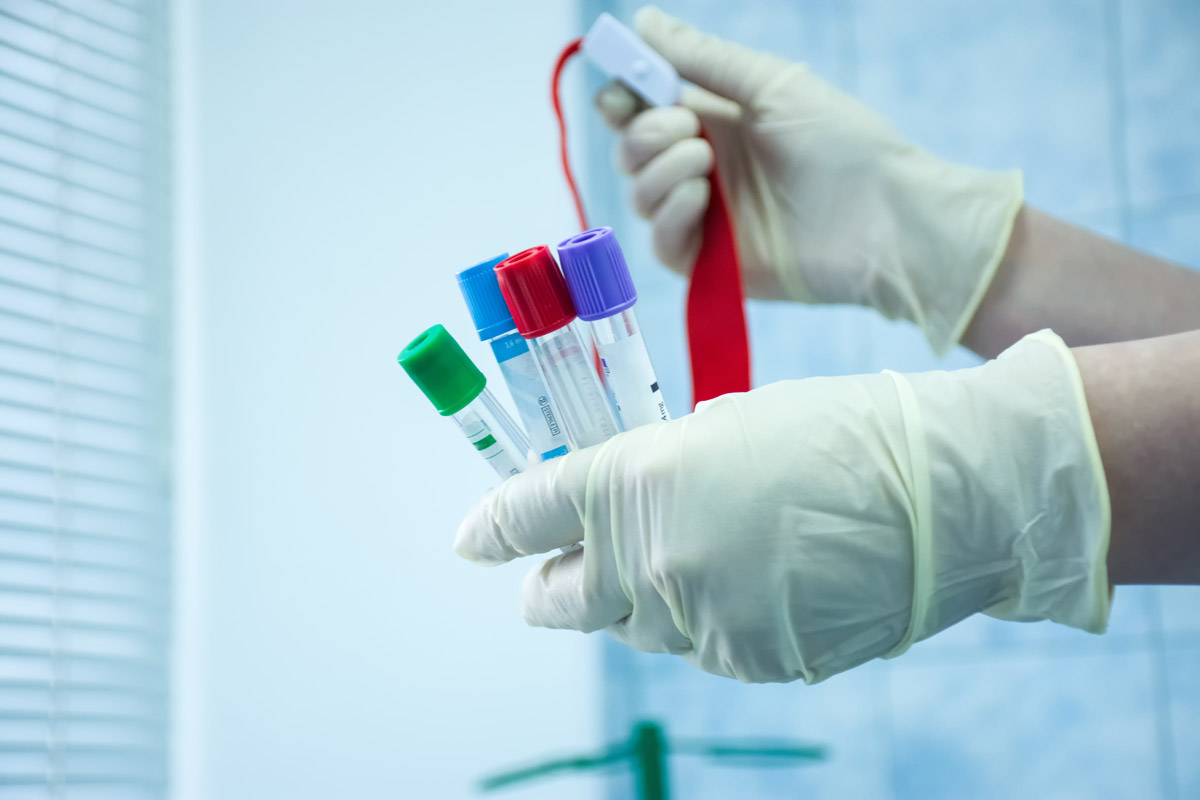 Lipid panel blood test for cholesterol monitoring — Townsen Physician Group, Houston