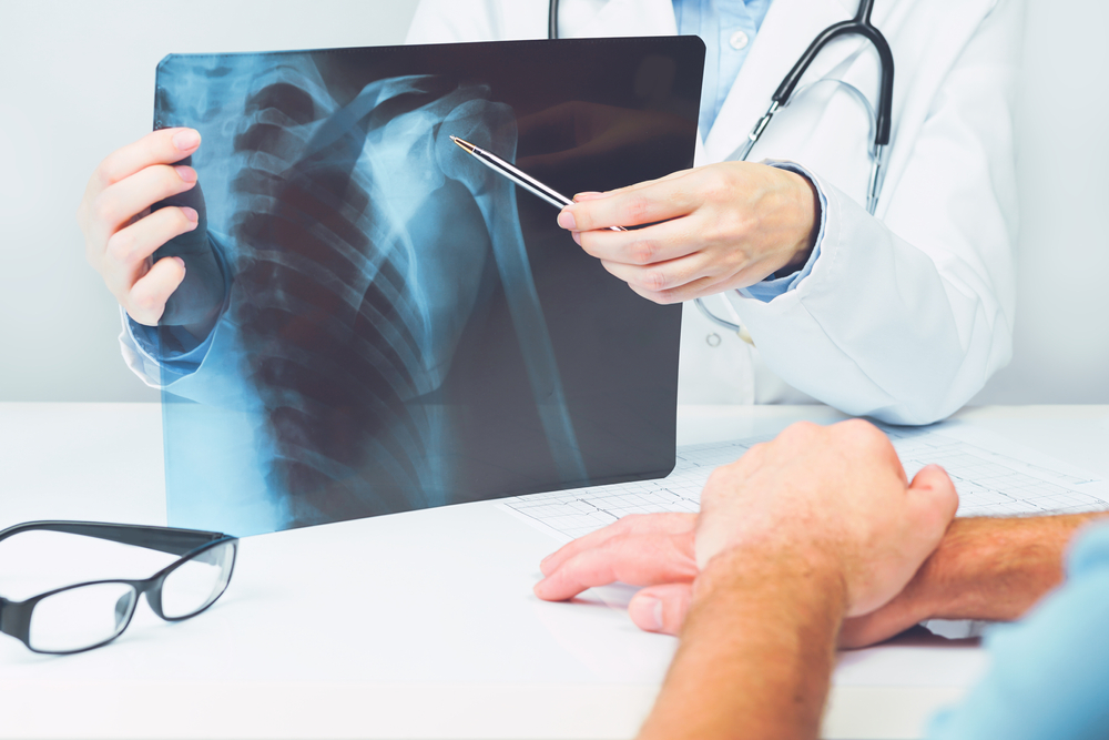 shoulder x-ray consultation