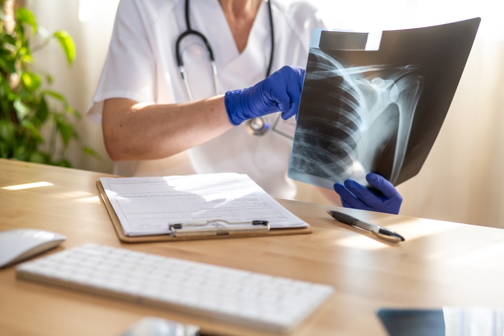 shoulder x-ray