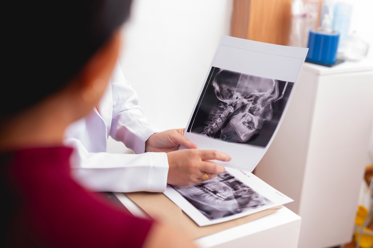 doctor showing jaw side XRAY to patient